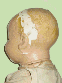 Click to see restoration